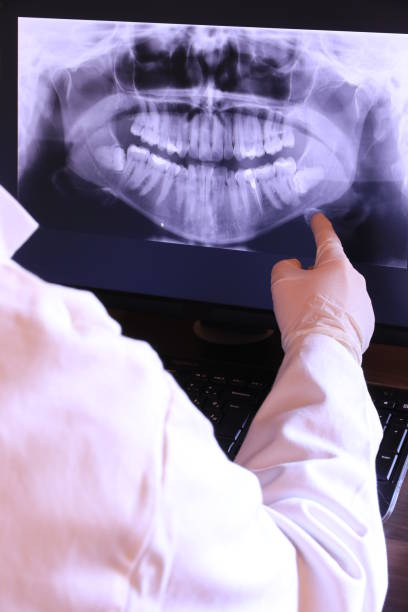 Best Dental Abscess Treatment in Vicksburg, MS