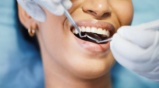 Best Emergency Root Canal Therapy in Vicksburg, MS